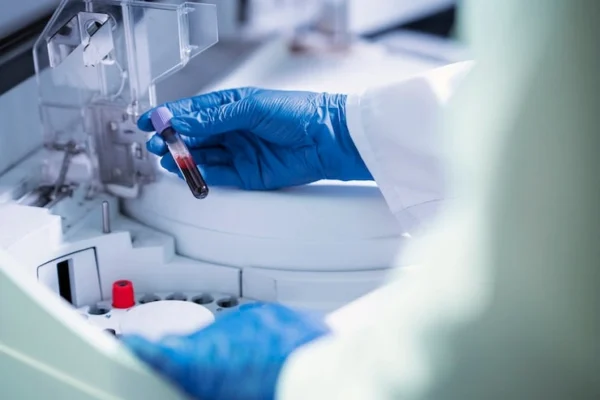 Lab technician in blue gloves holds a small blood sample vial near a laboratory centrifuge or analyzer.